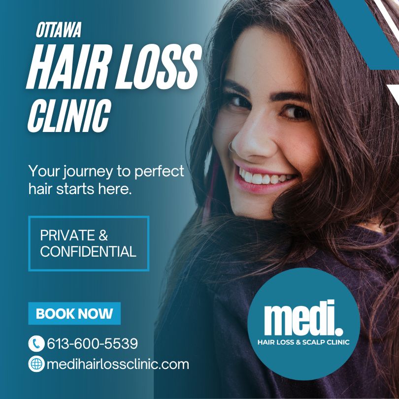 Thinning hair experts in Ottawa at Medi Hair Loss Clinic