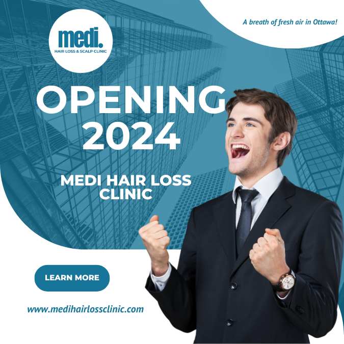 Medi hair loss clinic Ottawa ad